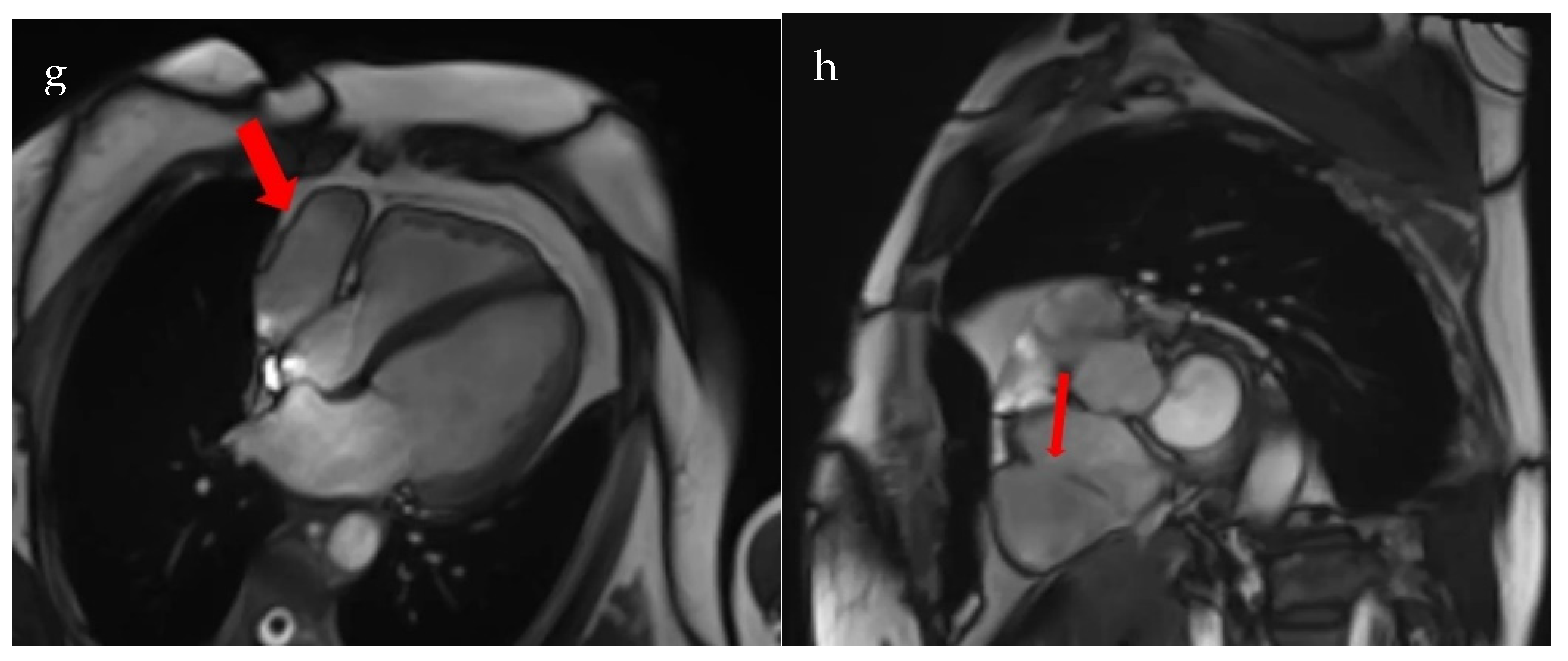 Diagnostics 15 02058 g003b