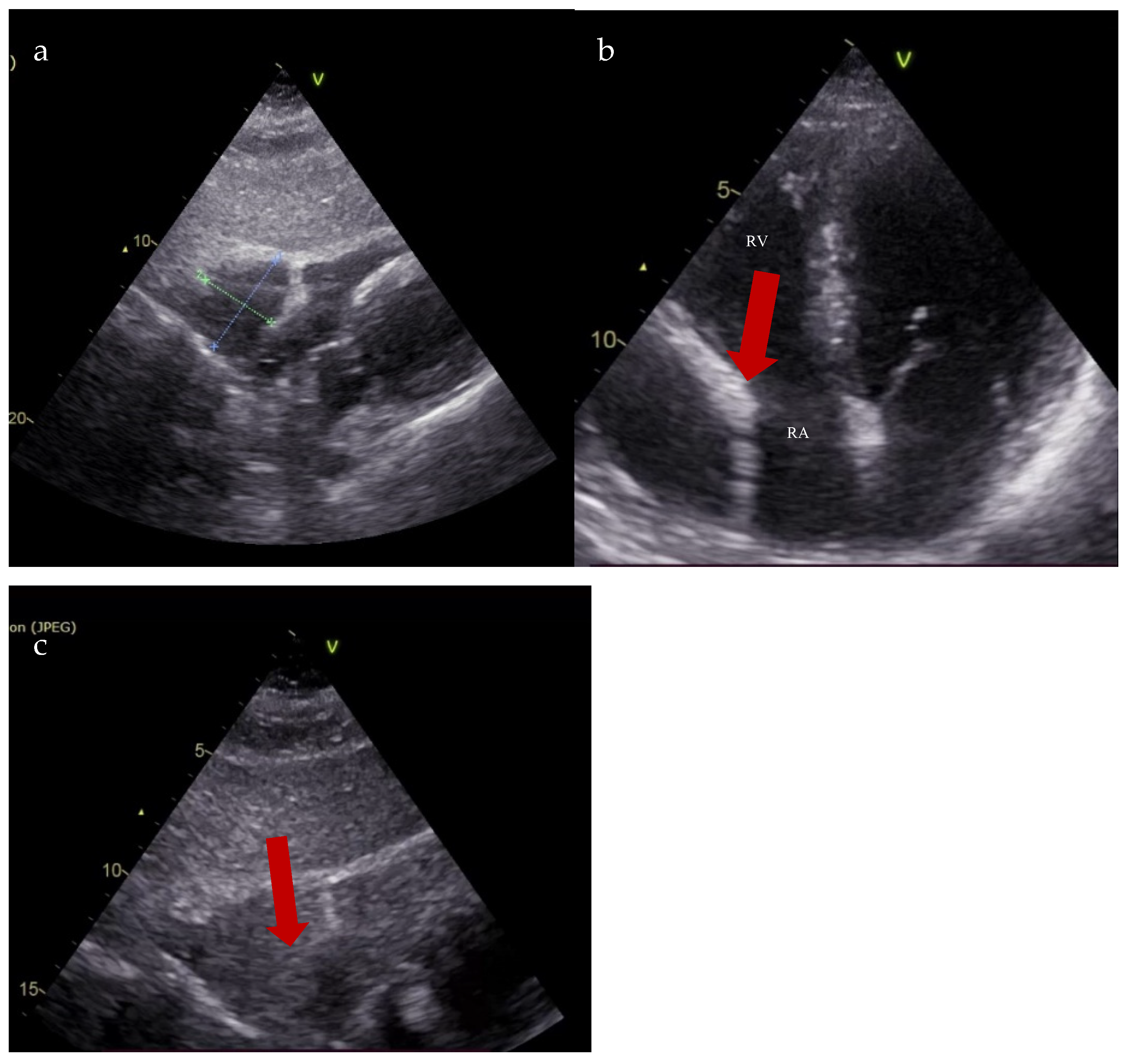 Diagnostics 15 02058 g004