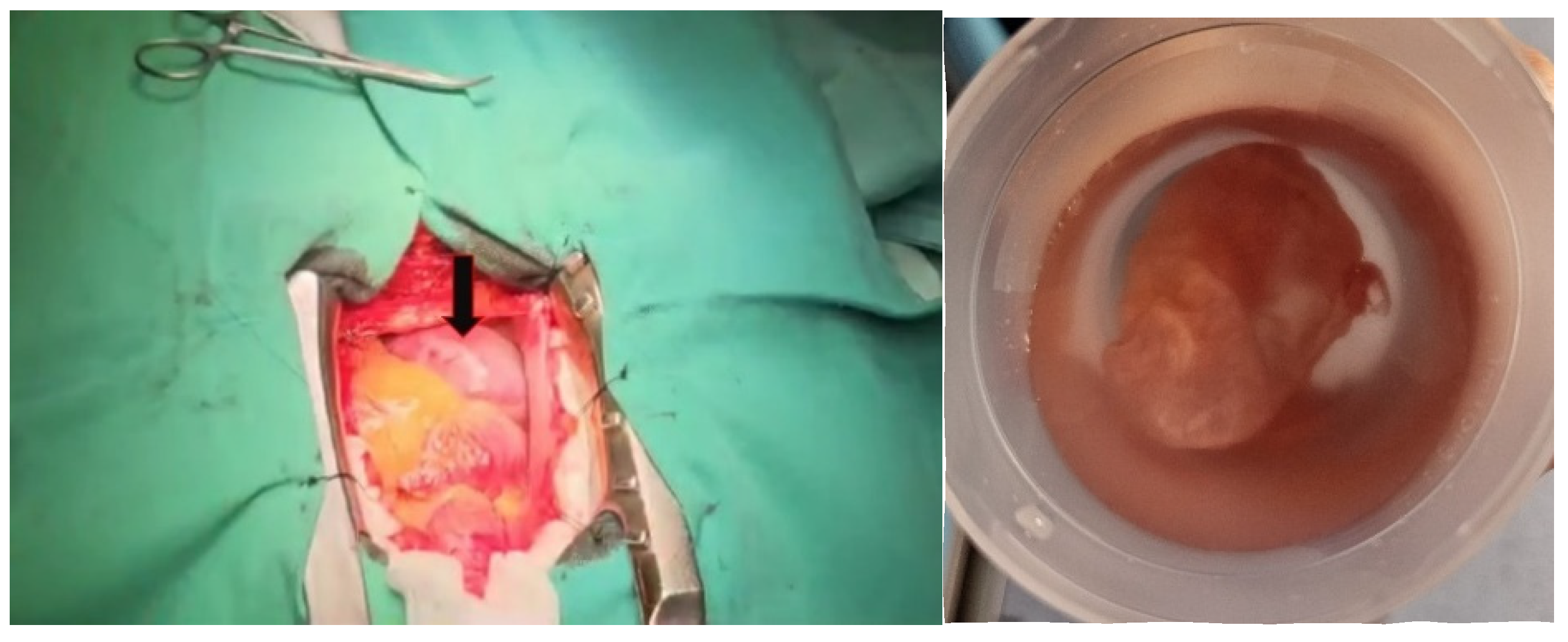 Diagnostics 15 02058 g005