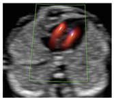 Diagnostics 15 02088 i001 Diagnostics 15 02088 i001