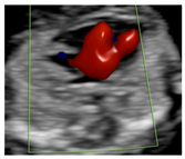 Diagnostics 15 02088 i002 Diagnostics 15 02088 i002