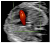 Diagnostics 15 02088 i003 Diagnostics 15 02088 i003