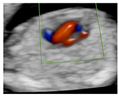 Diagnostics 15 02088 i004 Diagnostics 15 02088 i004