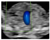 Diagnostics 15 02088 i006 Diagnostics 15 02088 i006