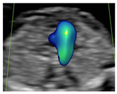 Diagnostics 15 02088 i007 Diagnostics 15 02088 i007