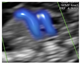 Diagnostics 15 02088 i008 Diagnostics 15 02088 i008