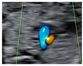 Diagnostics 15 02088 i009 Diagnostics 15 02088 i009