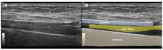 Diagnostics 15 02106 g004