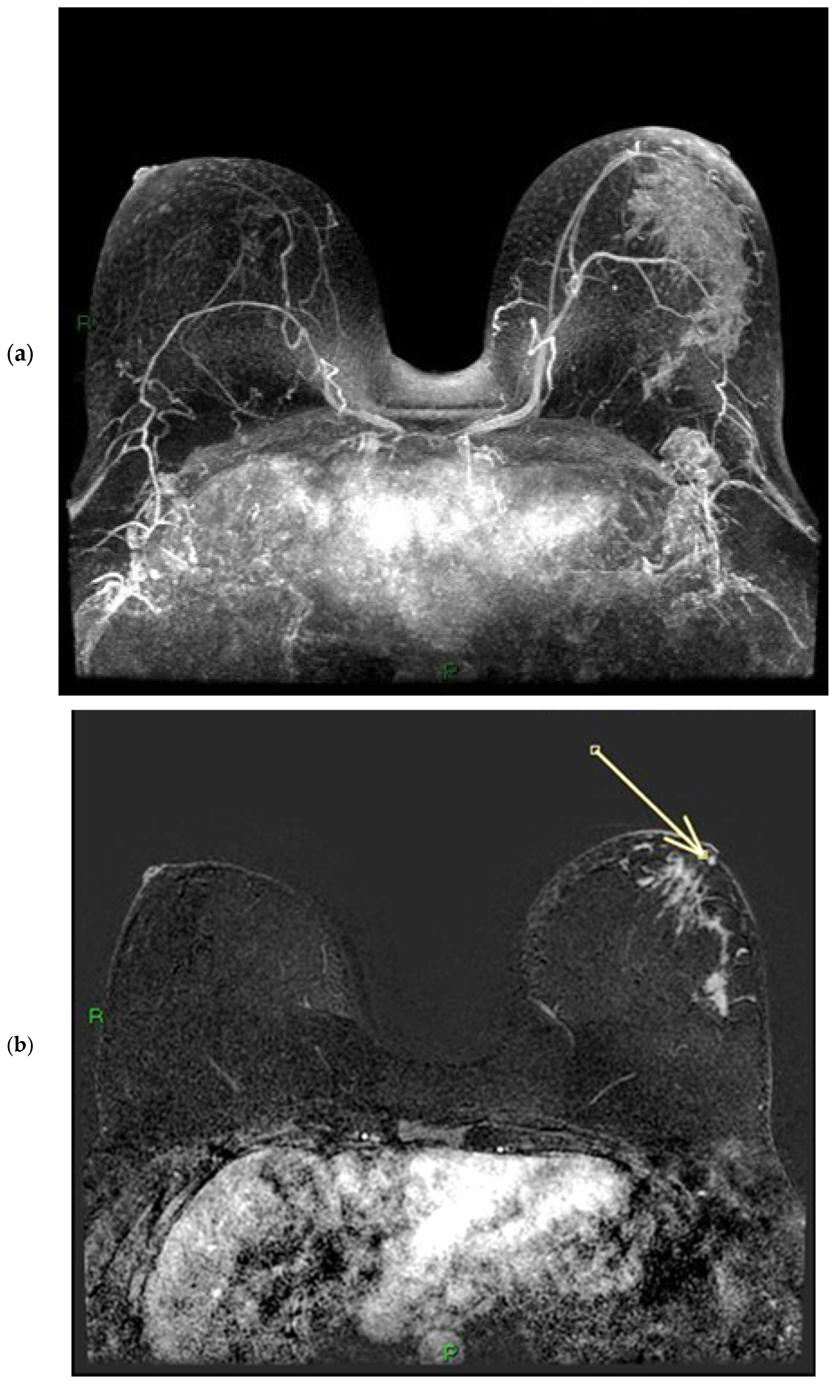 Diagnostics 15 02155 g004