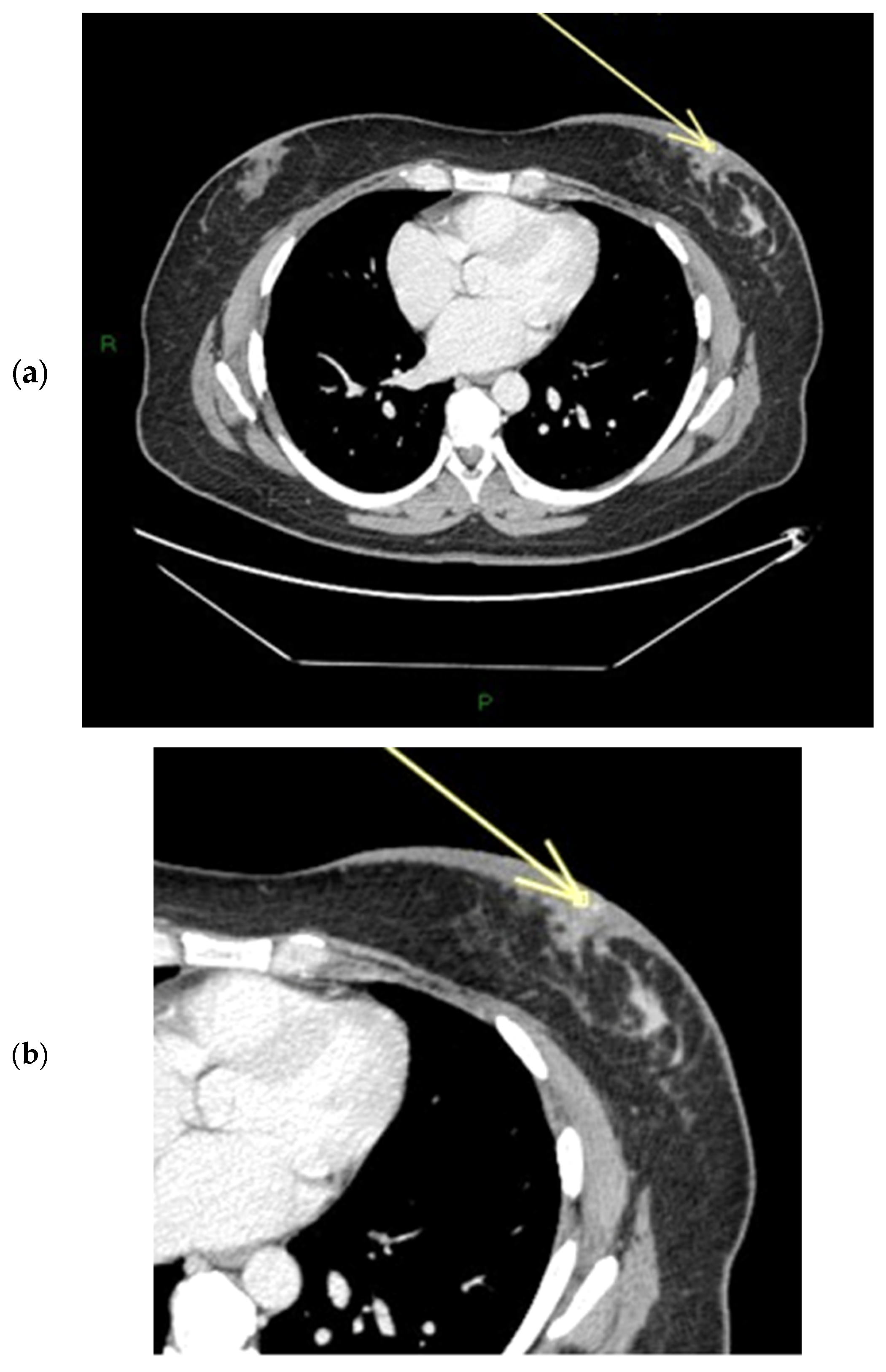 Diagnostics 15 02155 g005