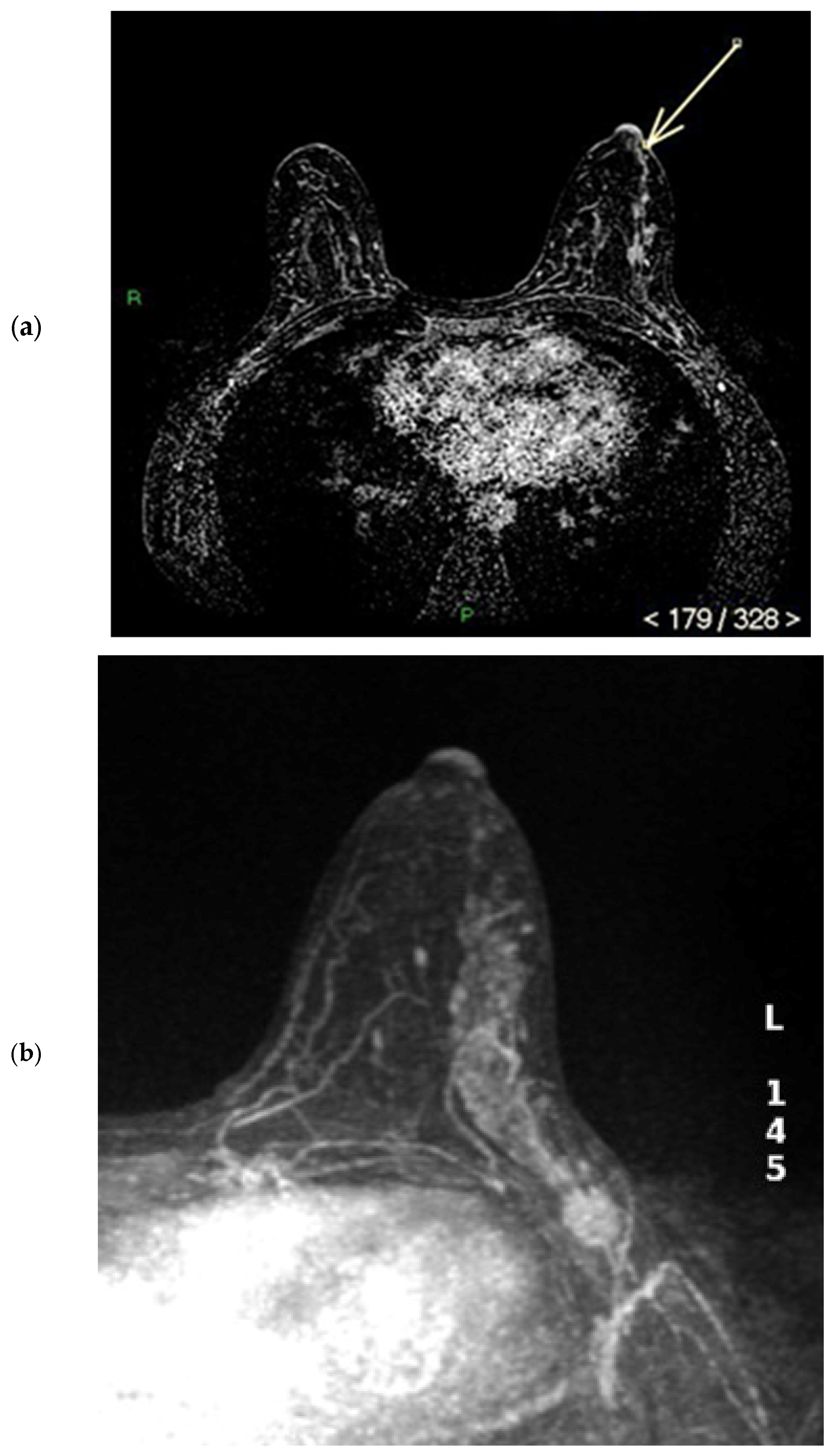 Diagnostics 15 02155 g007a