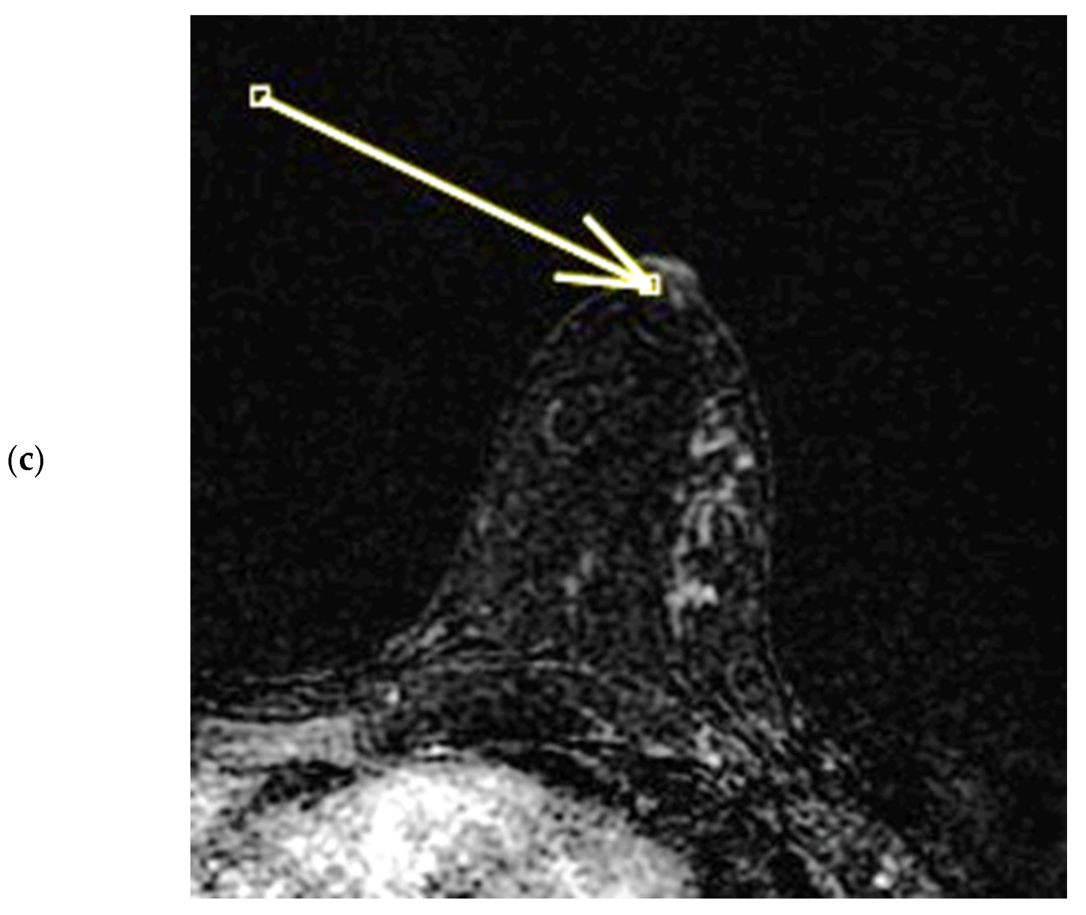 Diagnostics 15 02155 g007b