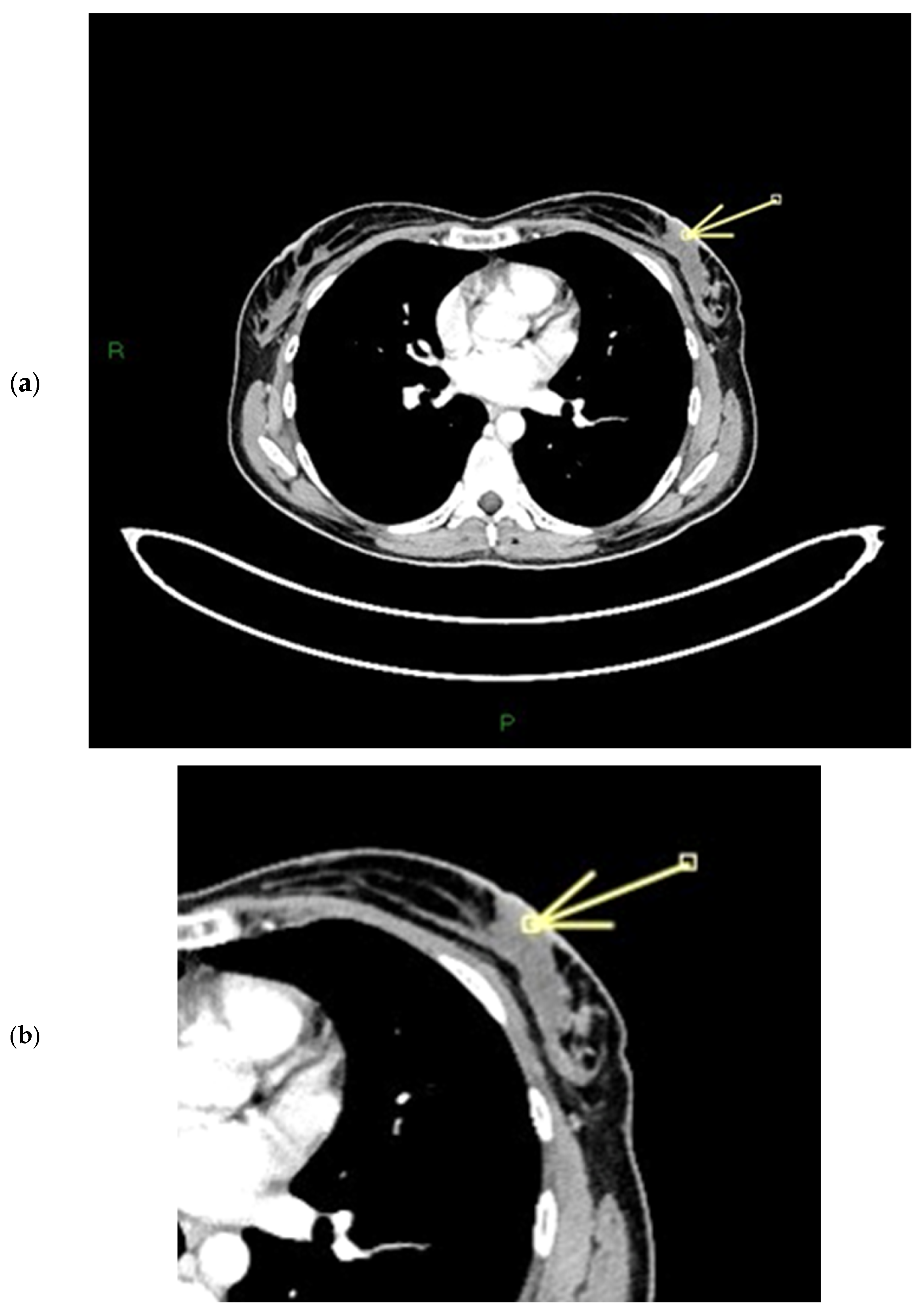 Diagnostics 15 02155 g008