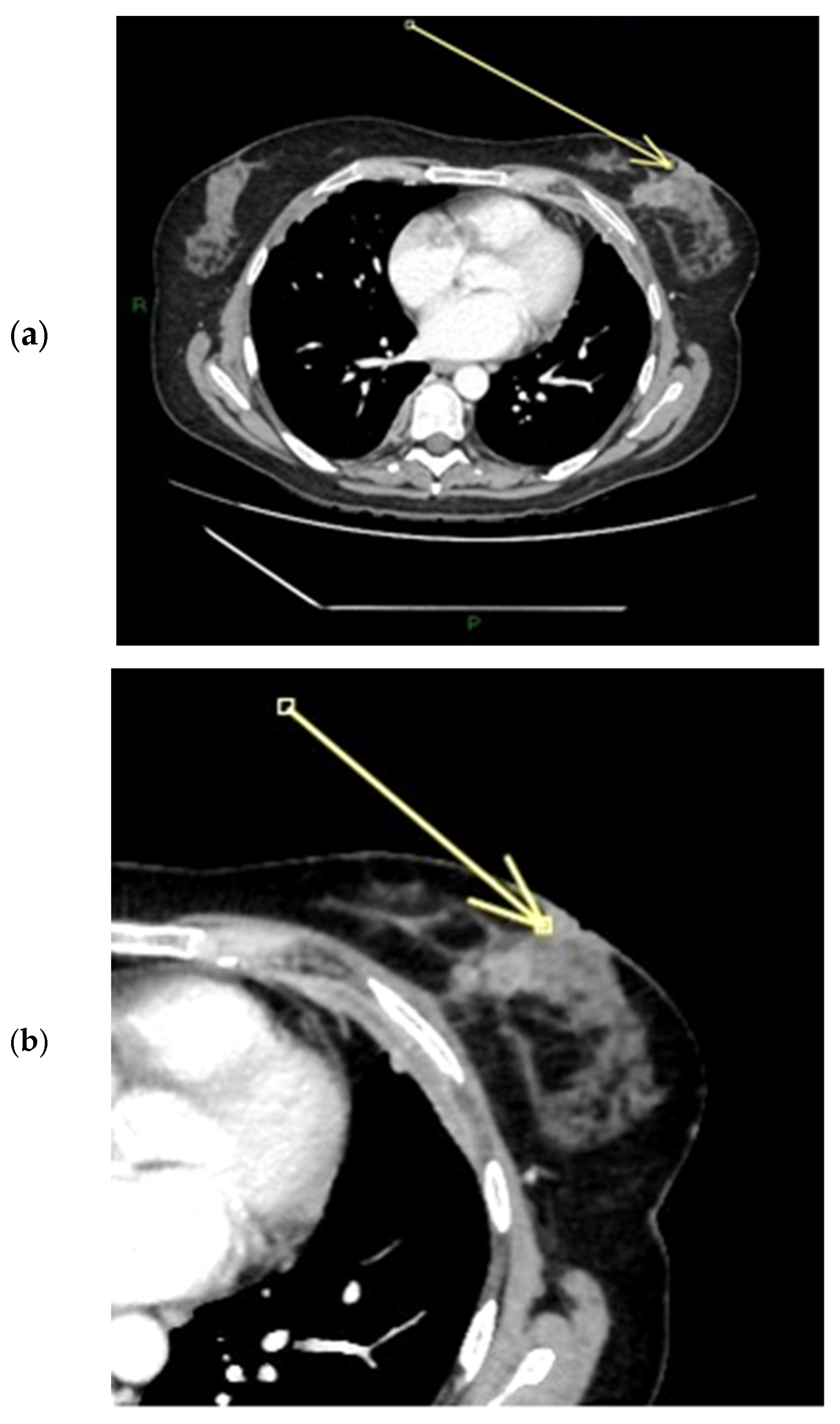 Diagnostics 15 02155 g010