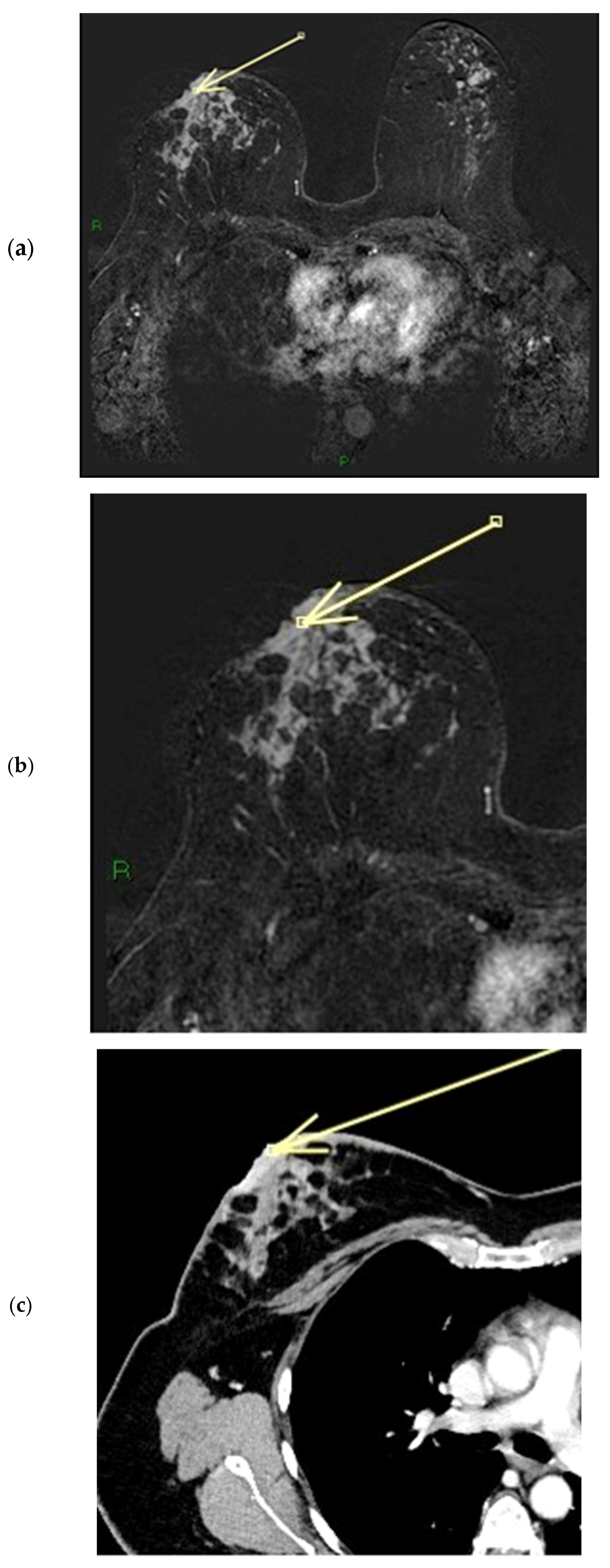 Diagnostics 15 02155 g012