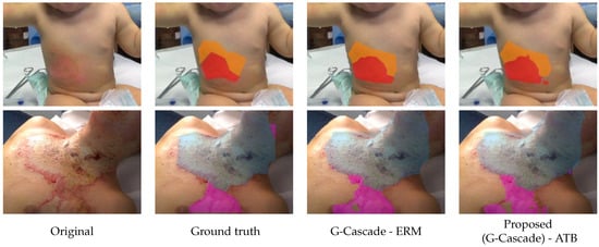 Diagnostics 15 02189 g005