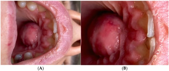 Diagnostics 15 02195 g001