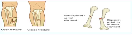 Diagnostics 15 02212 g001