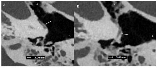 Diagnostics 15 02213 g001