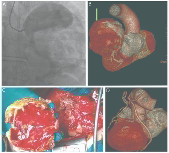 Diagnostics 15 02302 g001