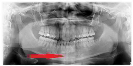 Diagnostics 15 02312 g001