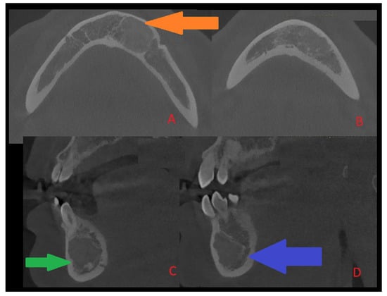 Diagnostics 15 02312 g002