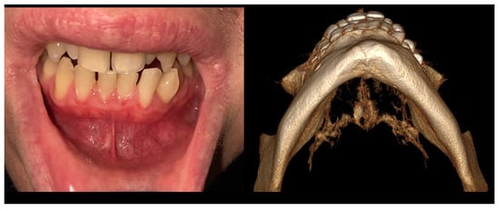 Diagnostics 15 02312 g003