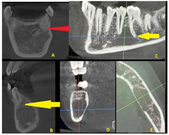 Diagnostics 15 02312 g005