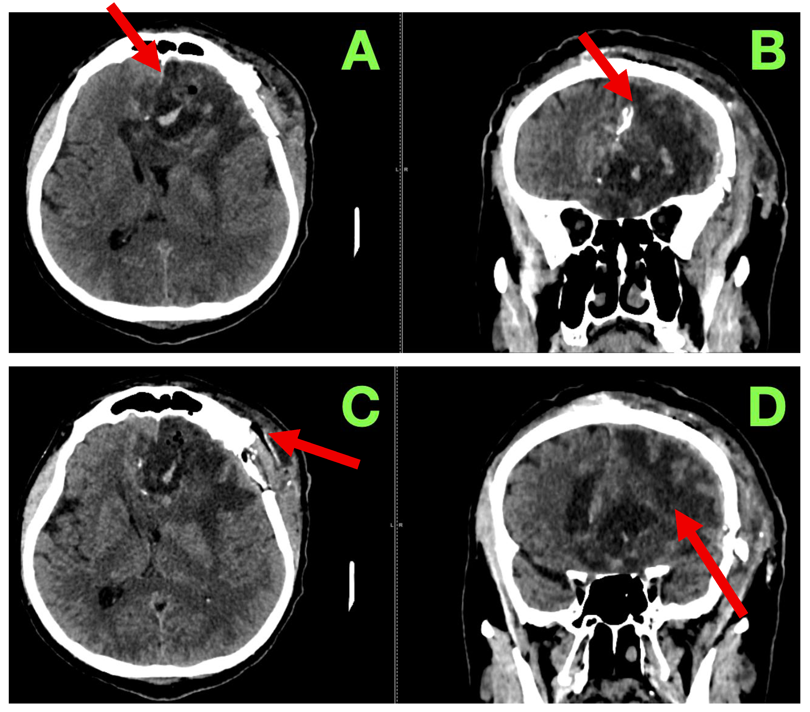 Diagnostics 15 02393 g002