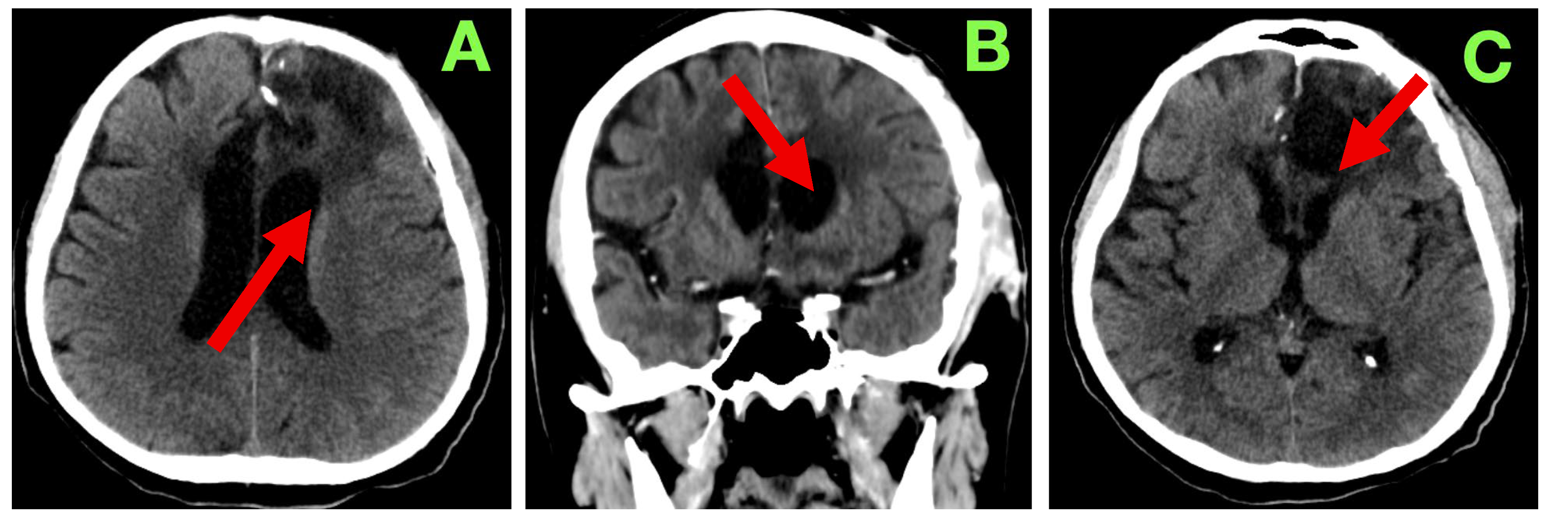 Diagnostics 15 02393 g003