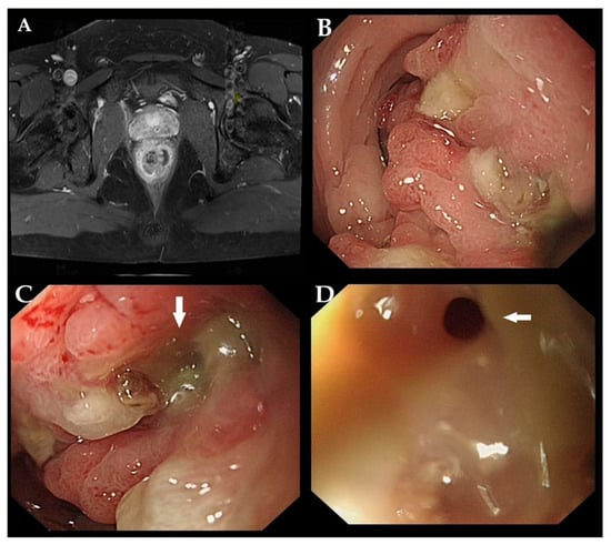 Diagnostics 15 02417 g001