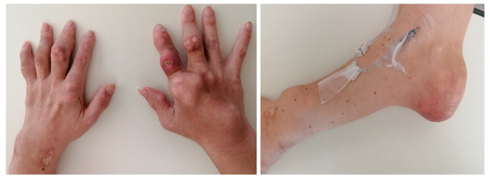 Diagnostics 15 02424 g001