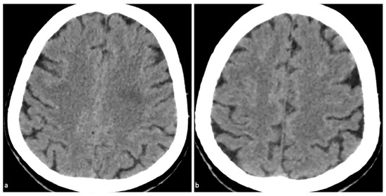 Diagnostics 15 02426 g003