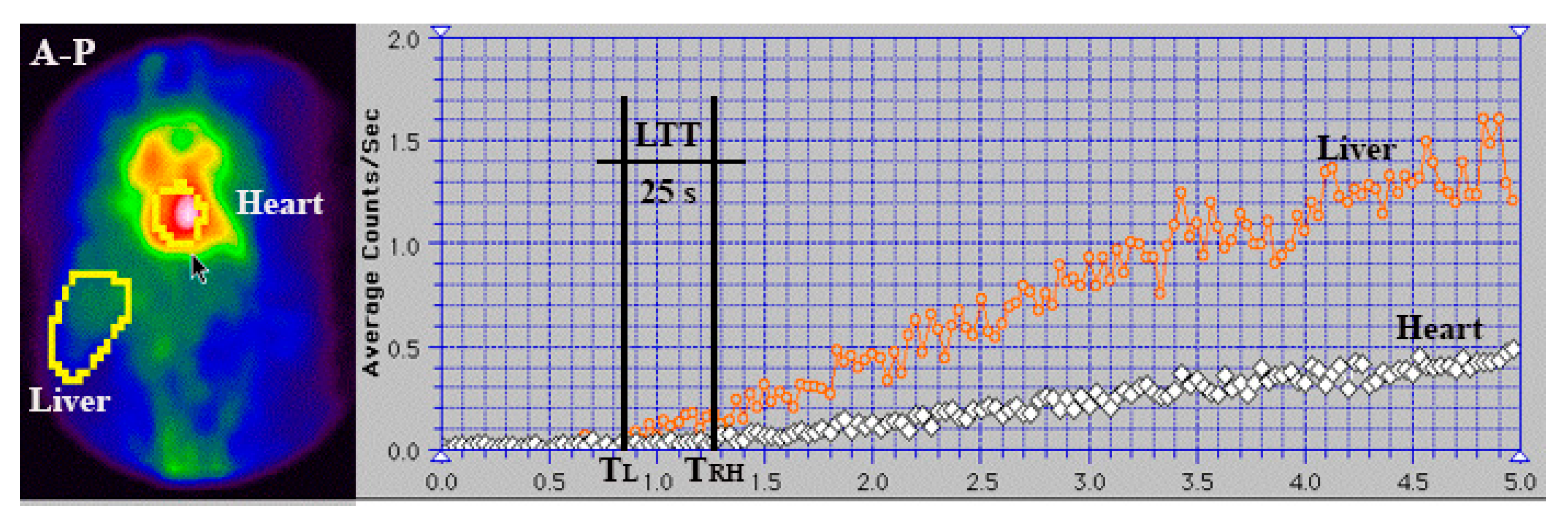 Diagnostics 15 02444 g008 Diagnostics 15 02444 g008
