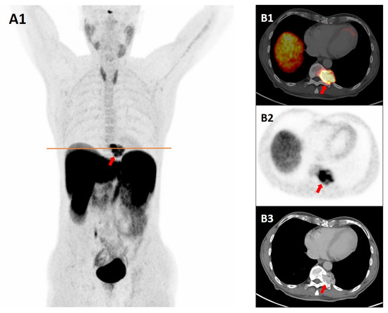 Diagnostics 15 02456 g001
