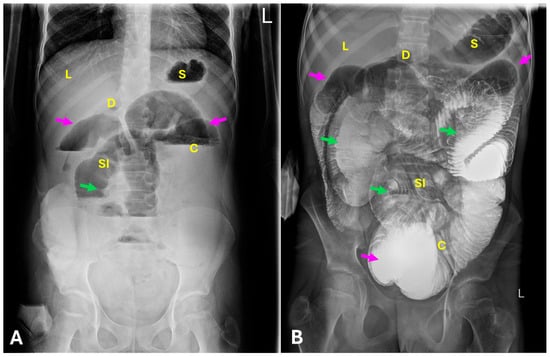 Diagnostics 15 02503 g001