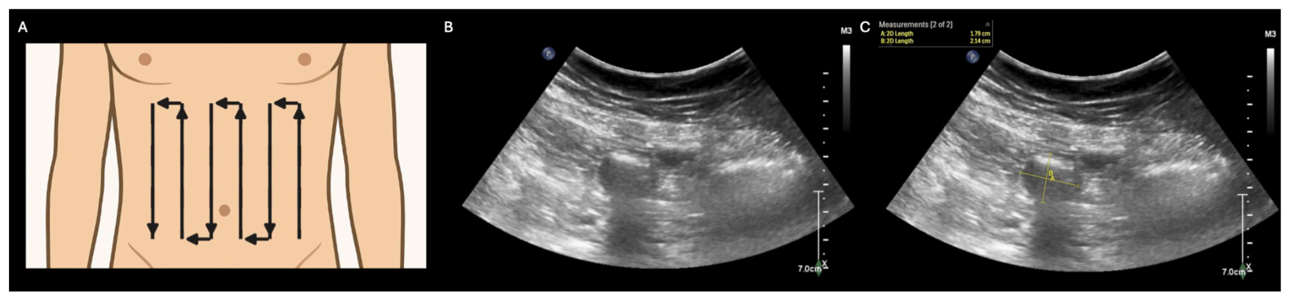 Diagnostics 15 02511 g001 Diagnostics 15 02511 g001