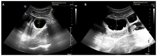 Diagnostics 15 02511 g003