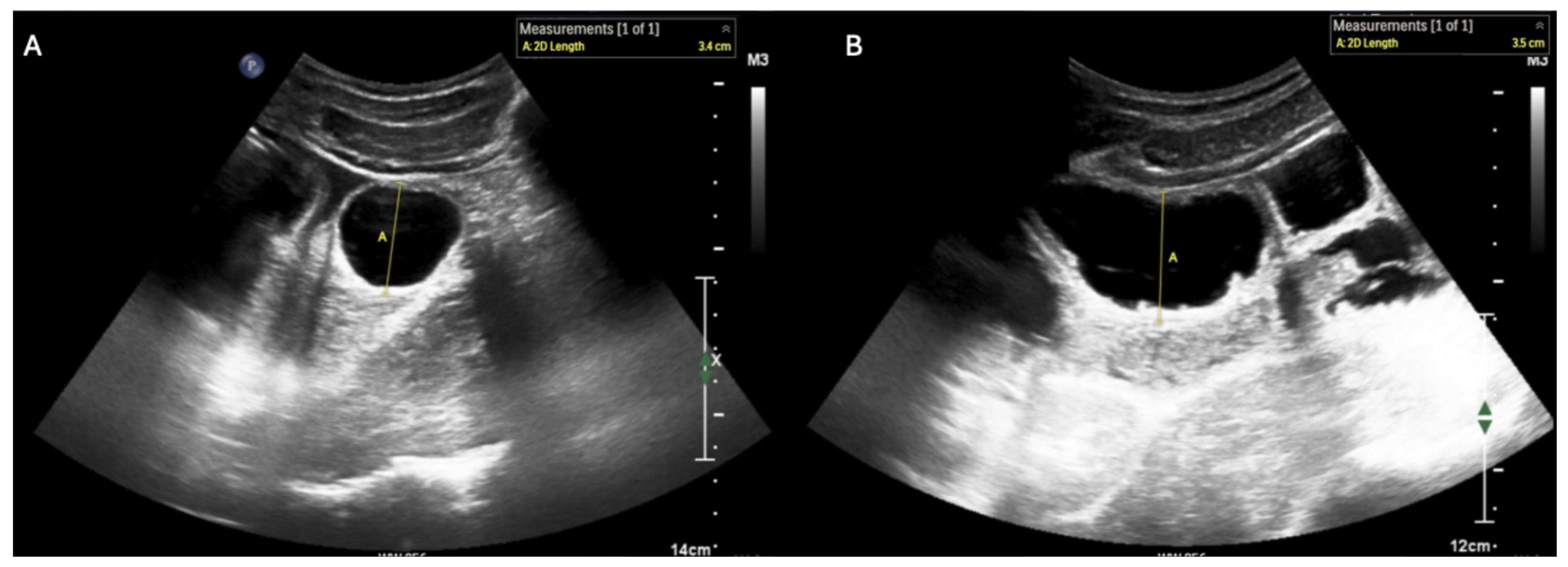 Diagnostics 15 02511 g003 Diagnostics 15 02511 g003