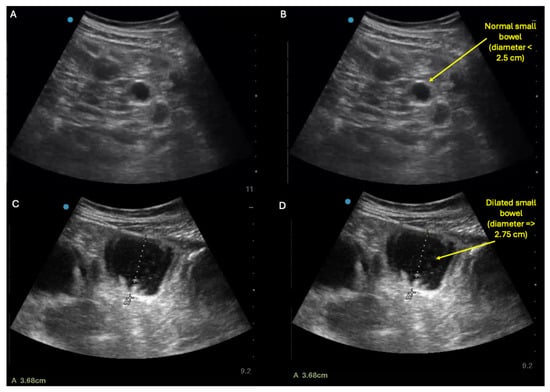 Diagnostics 15 02511 g004