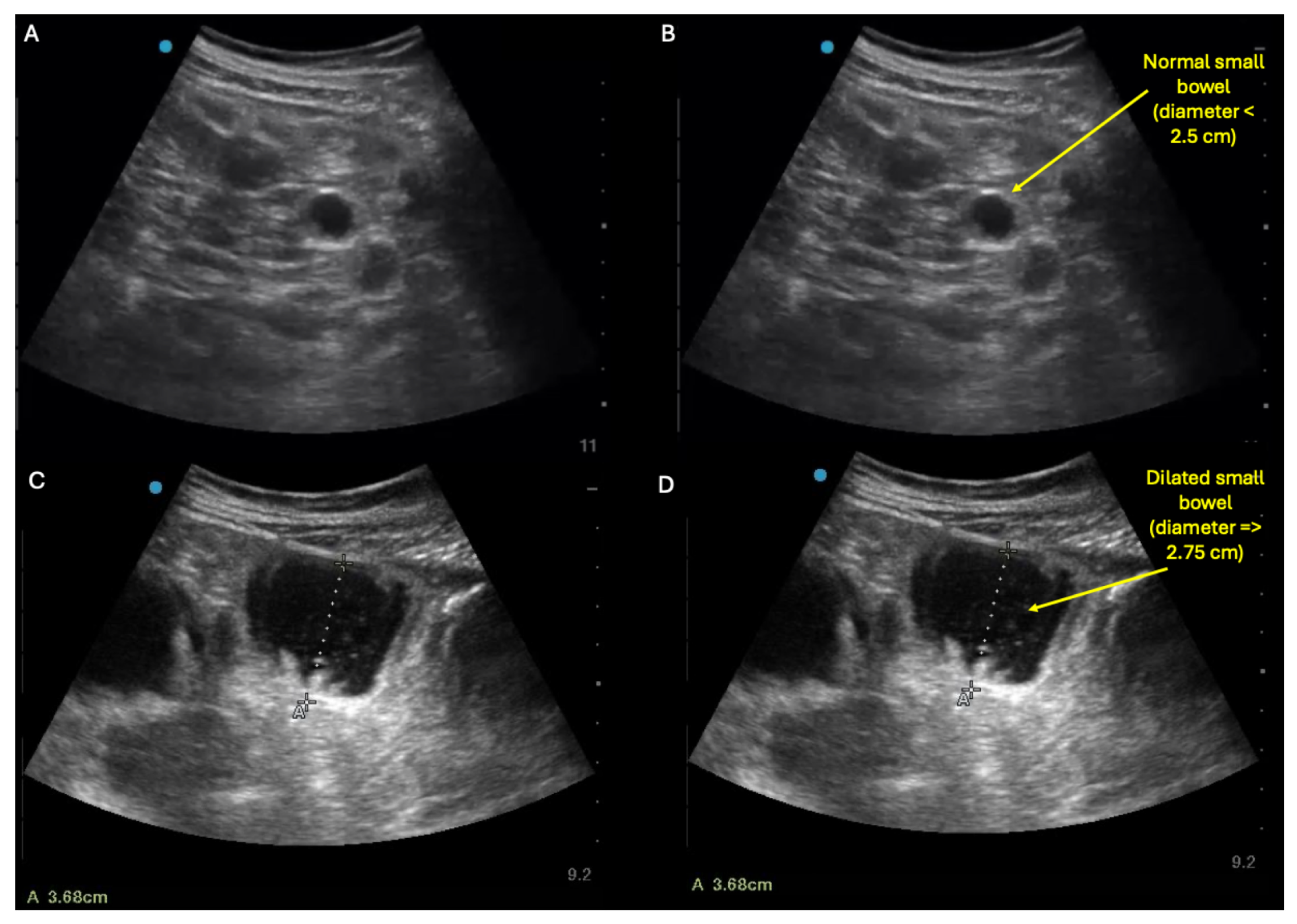 Diagnostics 15 02511 g004 Diagnostics 15 02511 g004