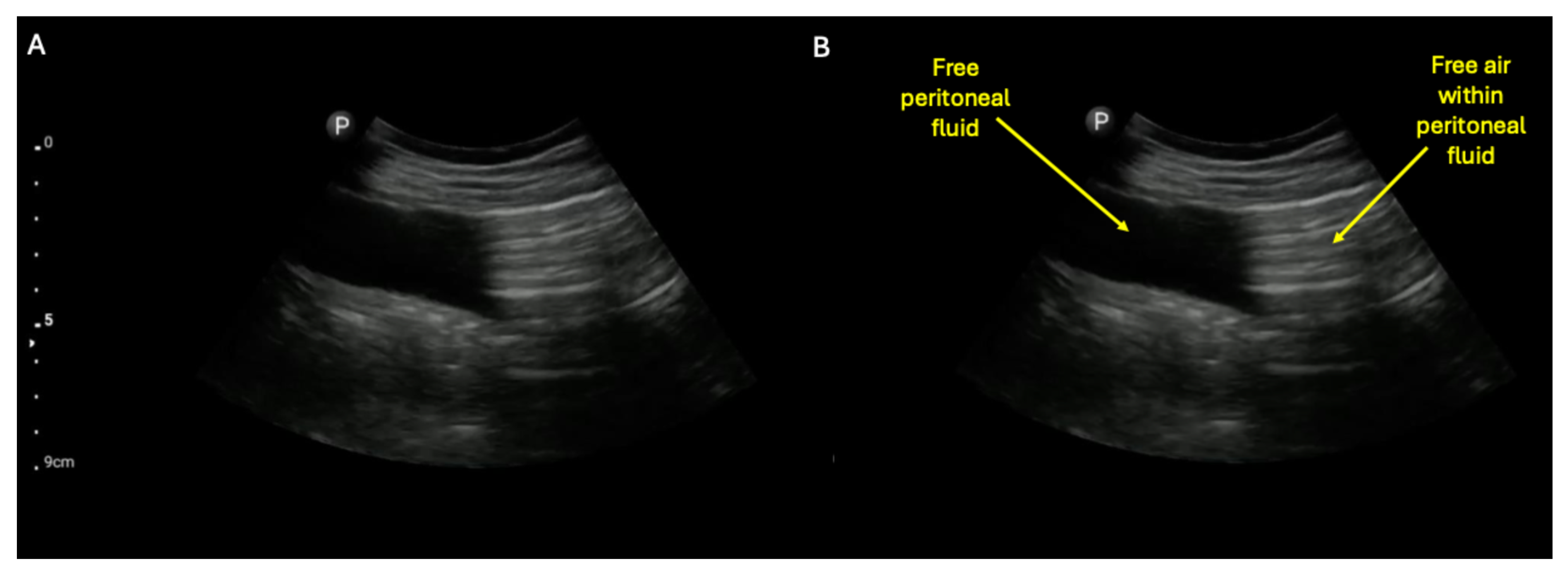 Diagnostics 15 02511 g005 Diagnostics 15 02511 g005