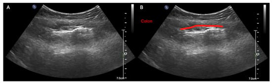 Diagnostics 15 02511 g006