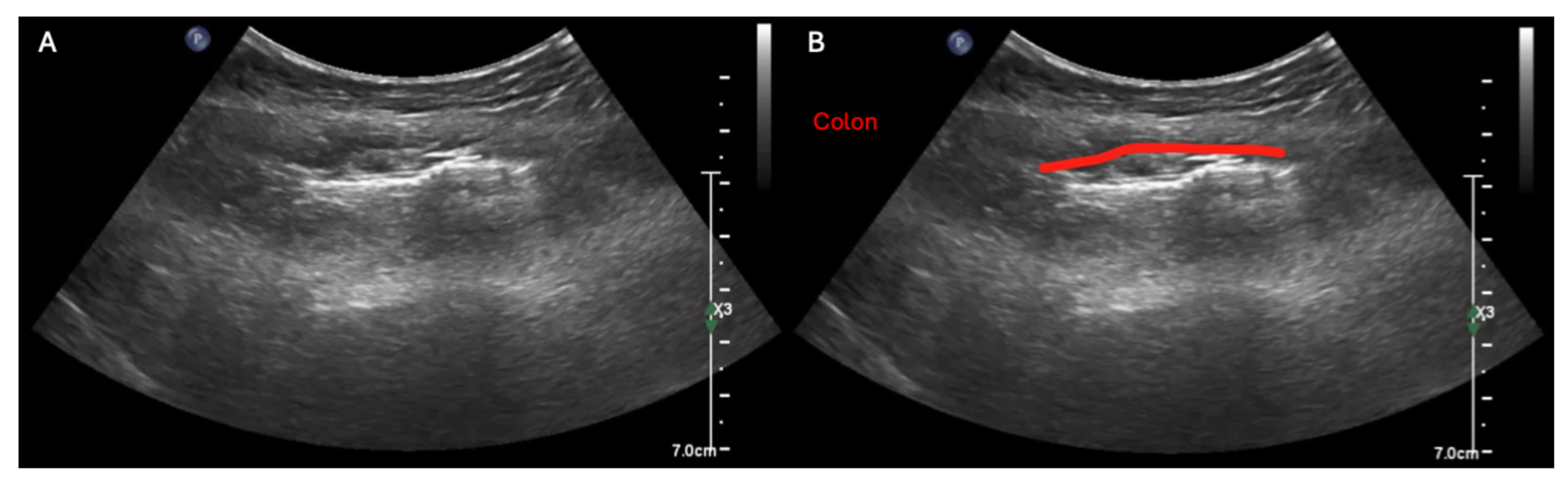 Diagnostics 15 02511 g006 Diagnostics 15 02511 g006