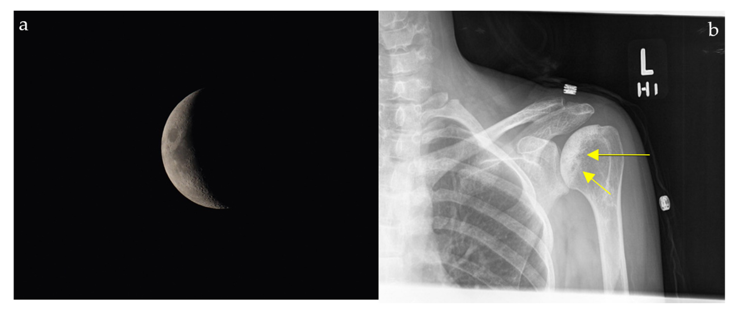 Diagnostics 15 02528 g011 Diagnostics 15 02528 g011