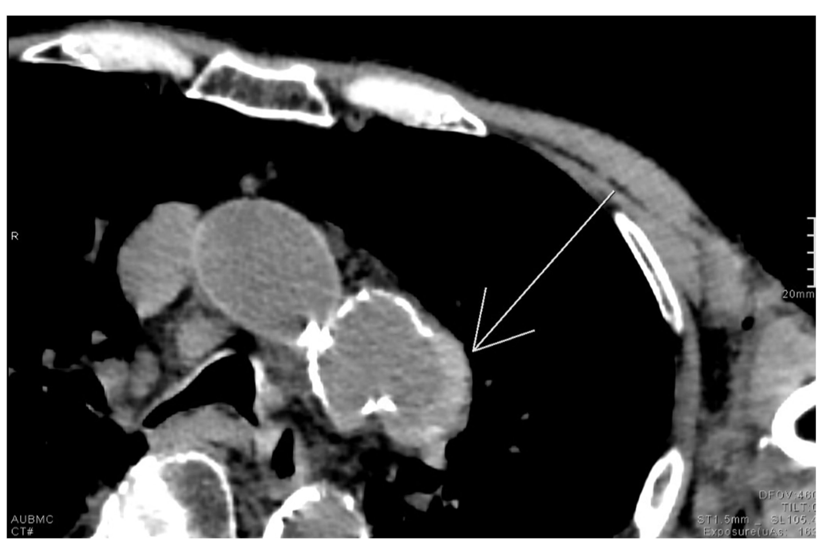 Diagnostics 15 02528 g012 Diagnostics 15 02528 g012
