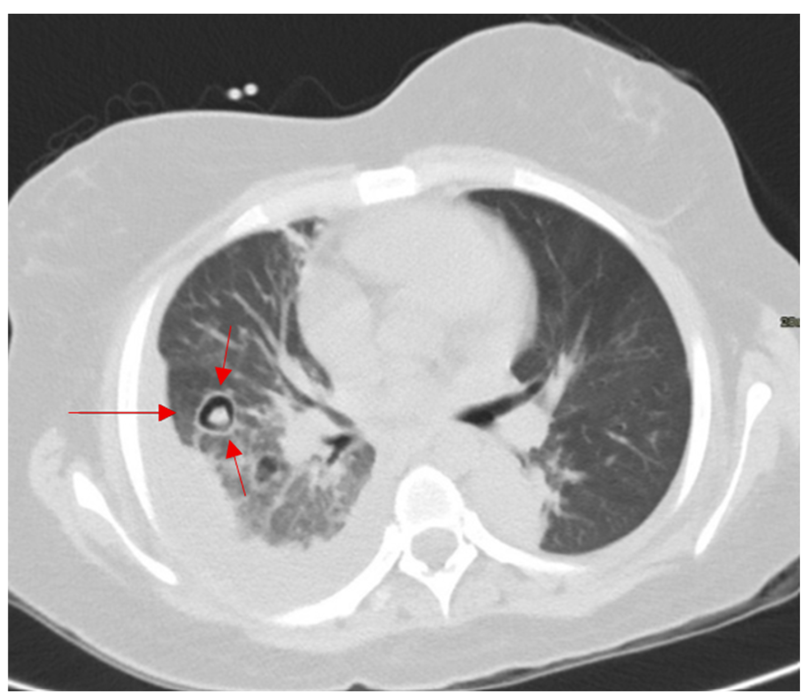 Diagnostics 15 02528 g014 Diagnostics 15 02528 g014