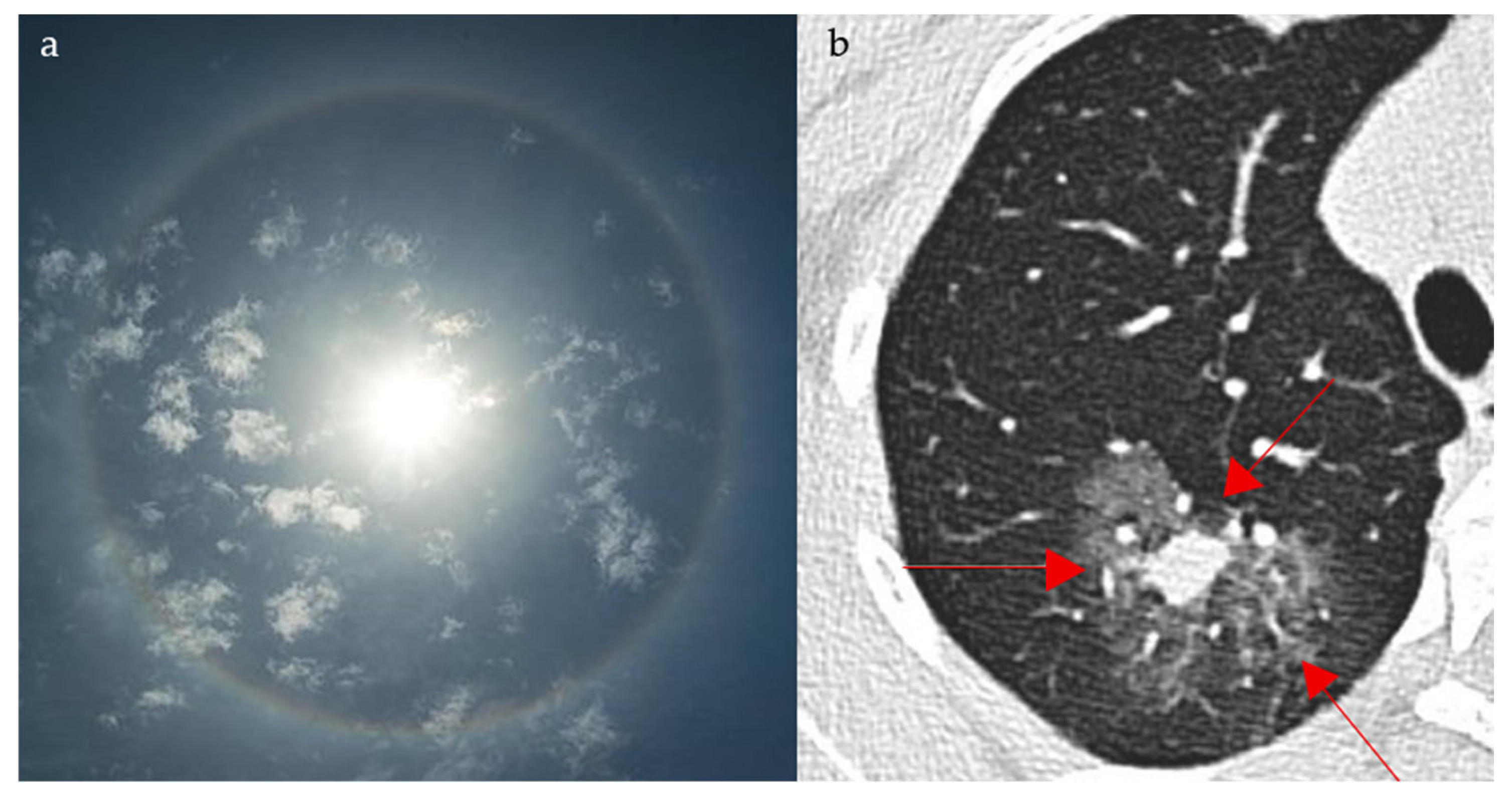 Diagnostics 15 02528 g015 Diagnostics 15 02528 g015