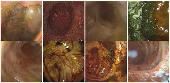 Diagnostics 15 02558 g0a1