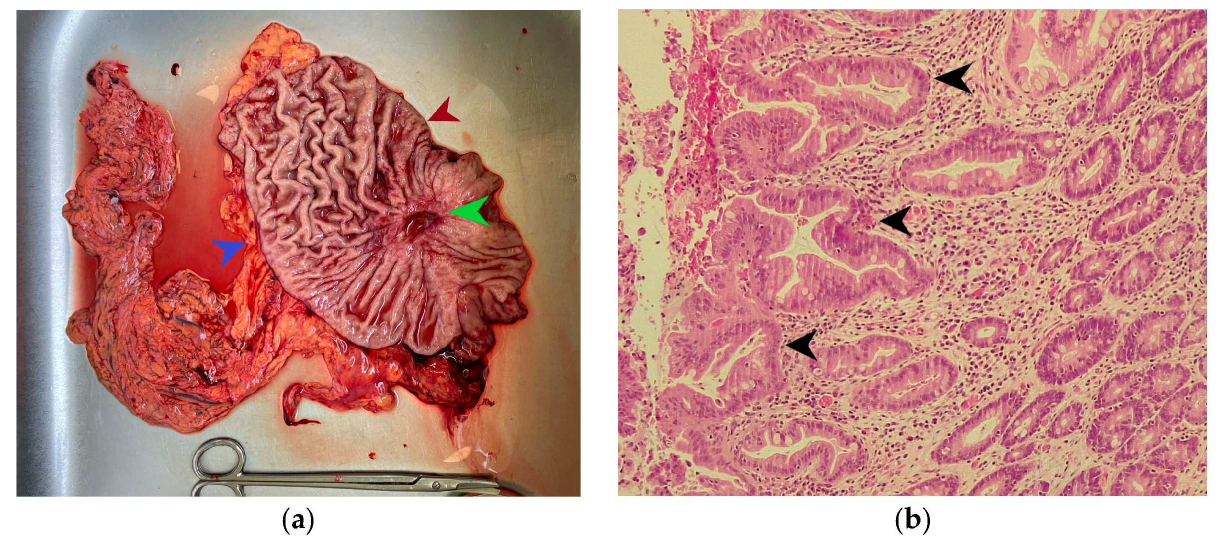 Diagnostics 15 02570 g001